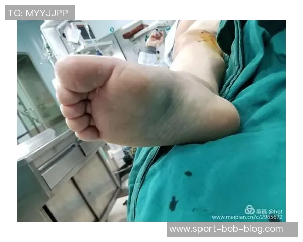 马德里竞技官方宣布朗格莱遭遇重度内侧副韧带扭伤无其他损伤 马德里竞技官方宣布朗格莱遭遇重度内侧副韧带扭伤无其他损伤